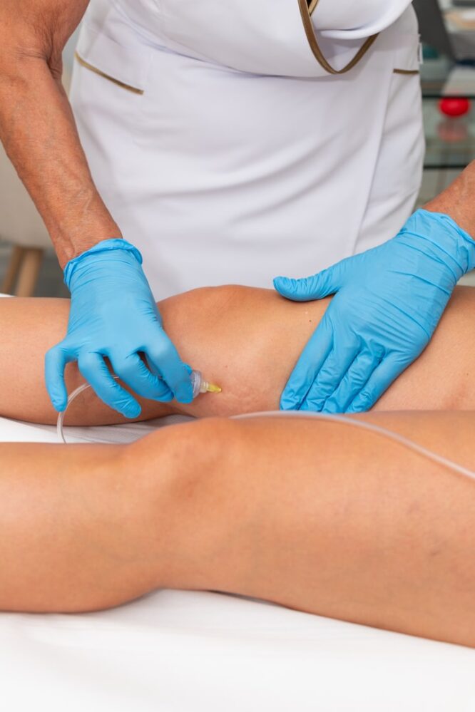 Carboxiterapia Dioxage 2